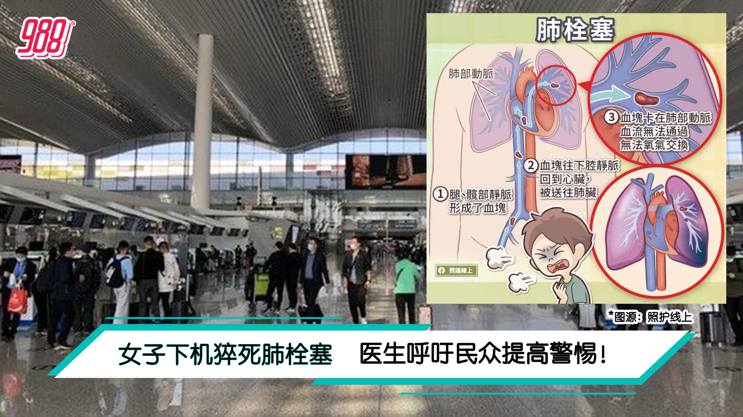 Topic image