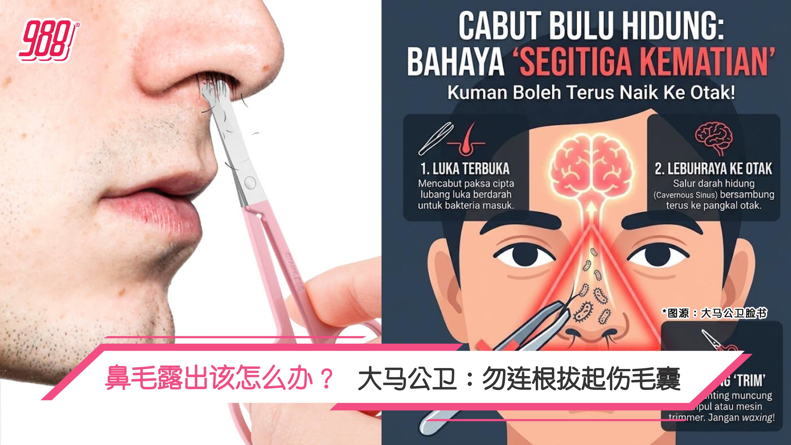Topic image